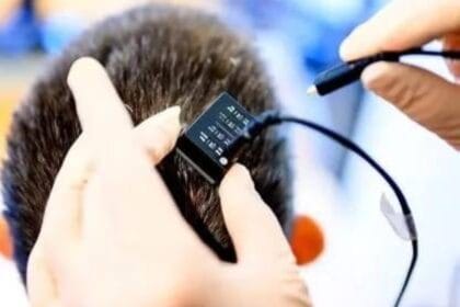 ثورة علمية.. شريحة دماغية تترجم الأفكار إلى كلام منطوق في ثوانٍ