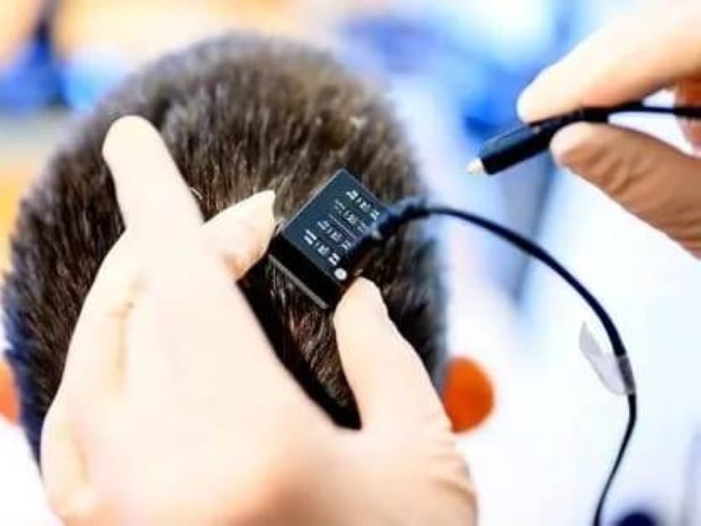 ثورة علمية.. شريحة دماغية تترجم الأفكار إلى كلام منطوق في ثوانٍ