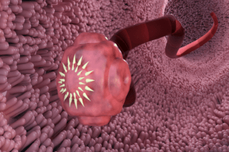 علامات تحذيرية لإصابتك بالديدان الطفيلية