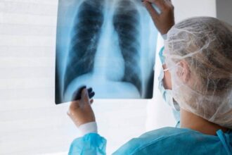 كبار السن في خطر.. حقائق صادمة عن الالتهاب الرئوي المزدوج