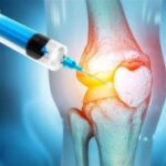 أضرار حُقن الكورتيزون للركبة.. أكثر من فائدتها على المدى الطويل