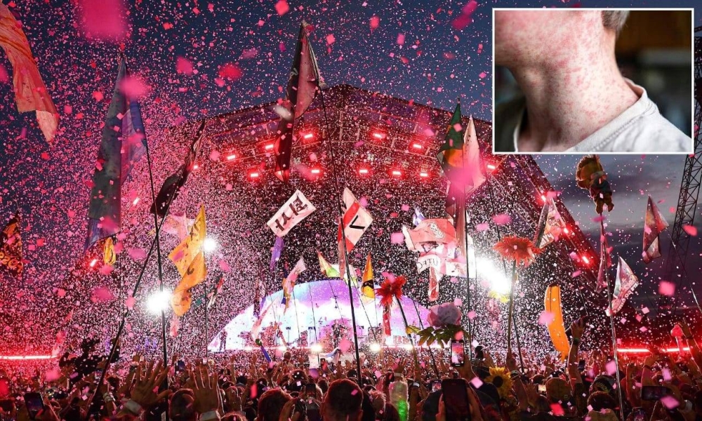 200 ألف زائر في خطر.. الحصبة تتربص بمهرجان «جلاستونبري»