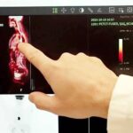 علاج جديد يفتت الخلايا السرطانية بالأشعة تحت الحمراء