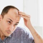 وداعاً للصلع.. اكتشاف علاج لتساقط الشعر باستخدام الخلايا الجذعية