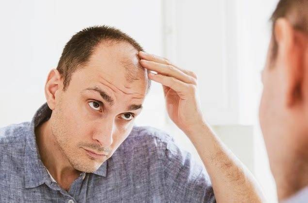 وداعاً للصلع.. اكتشاف علاج لتساقط الشعر باستخدام الخلايا الجذعية