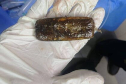 في واقعة نادرة.. استخراج هاتف محمول من بطن شاب مصري بعد عامين من ابتلاعه