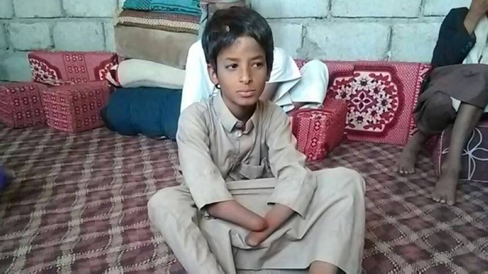 «مسام» ينتزع 3699 لغماً حوثياً في أقل من شهر «مسام» ينتزع 3699 لغماً حوثياً في أقل من شهر