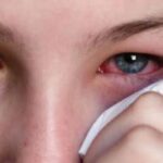 فايروسات غُدية تهدد الرؤية.. تحذير عاجل من أطباء العيون في ألمانيا