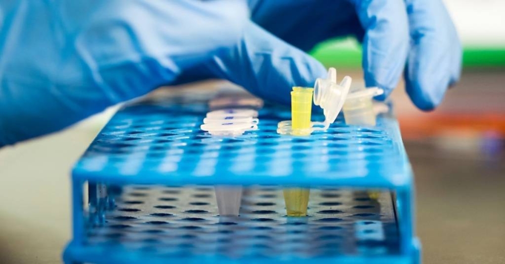 أبٌ يزوِّر اختبار DNA للهروب من النفقة.. والأم تقوده للسجن