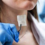 تجديد حنجرة مريض السرطان بطابعة ثلاثية الأبعاد