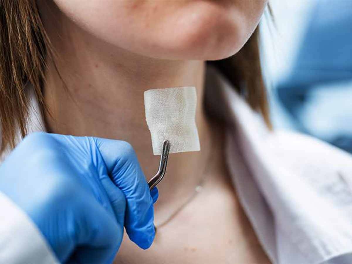 تجديد حنجرة مريض السرطان بطابعة ثلاثية الأبعاد