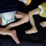 غزة : ارتفاع ملحوظ بمعدلات الوفيات الناتجة عن الجوع وسوء التغذية​ 