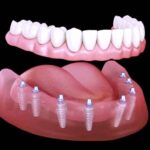 اكتشاف مركب طبيعي يحارب تسوّس الأسنان