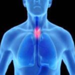 ابتكار كبسولة للكشف المبكر عن سرطان المريء