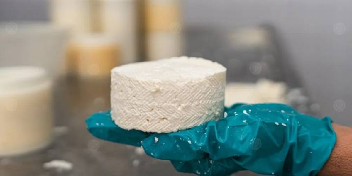 تفشي عدوى في فرنسا مرتبط بتناول أجبان منتشرة في أوروبا تفشي عدوى في فرنسا مرتبط بتناول أجبان منتشرة في أوروبا