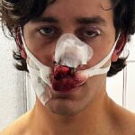 طعنات تشوه وجه عارض أزياء أمريكي أثناء دفاعه عن سيدتين