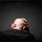 اختراق في علاج الصلع والنتائج خلال شهرين