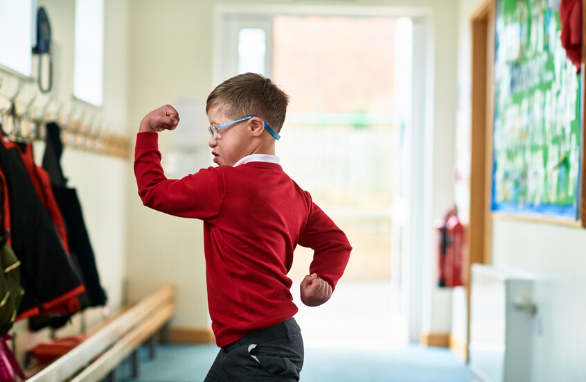 تقنية ثورية قد تساعد في علاج متلازمة داون