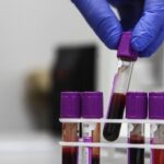 عالم أمريكي يفجر مفاجأة كبرى عن منشأ كورونا