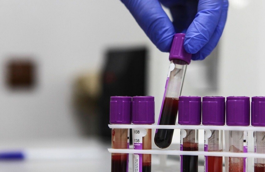 عالم أمريكي يفجر مفاجأة كبرى عن منشأ كورونا عالم أمريكي يفجر مفاجأة كبرى عن منشأ كورونا