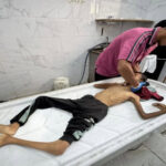 صحة غزة: 10 وفيات نتيجة المجاعة وسوء التغذية خلال الـ 24 ساعة الماضية​ 