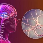 علماء أمريكيون يطوّرون غرسة دماغية تخفف الألم المزمن