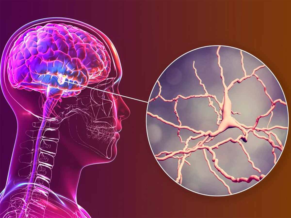علماء أمريكيون يطوّرون غرسة دماغية تخفف الألم المزمن علماء أمريكيون يطوّرون غرسة دماغية تخفف الألم المزمن