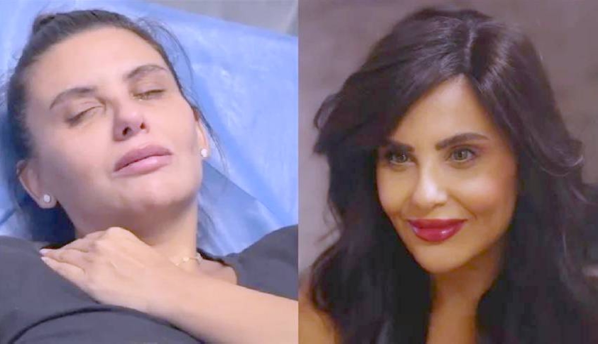حقن التجميل تُطيح بعافية دانا حمدان حقن التجميل تُطيح بعافية دانا حمدان
