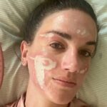 شابة تتهم خبيرة تجميل هوليوودية بتشويه وجهها إلى الأبد