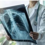 علماء روس يبتكرون جهاز أشعة سينية بحجم الهاتف الذكي