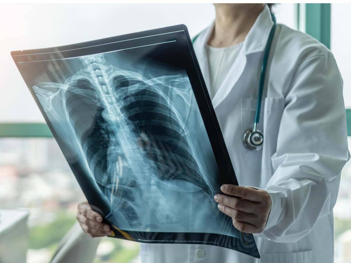 علماء روس يبتكرون جهاز أشعة سينية بحجم الهاتف الذكي علماء روس يبتكرون جهاز أشعة سينية بحجم الهاتف الذكي