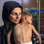 إسرائيل تصعّد في الضفة والقدس.. والتجويع يفتك بأطفال غزة