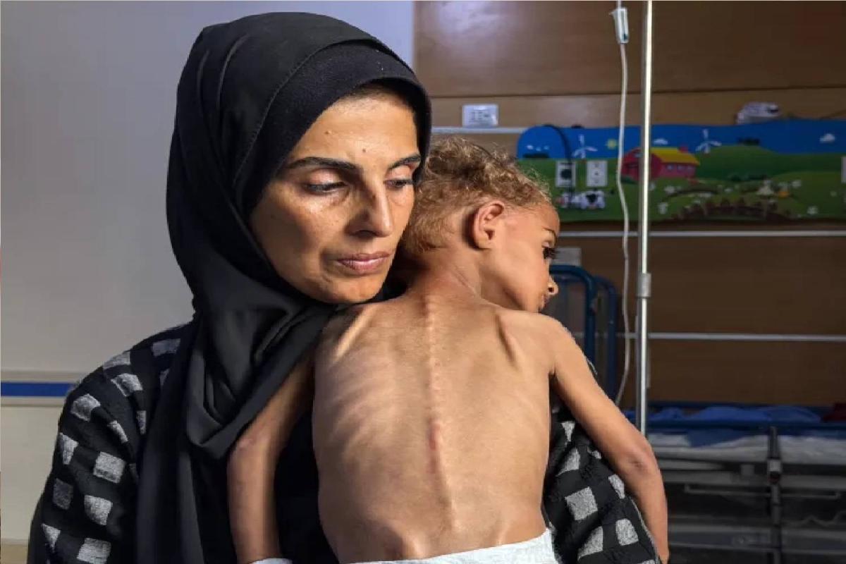 إسرائيل تصعّد في الضفة والقدس.. والتجويع يفتك بأطفال غزة إسرائيل تصعّد في الضفة والقدس.. والتجويع يفتك بأطفال غزة