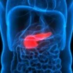 دراسة عالمية تحذّر: رائحة فمك قد تكون سبباً في الإصابة بـ«القاتل الصامت»