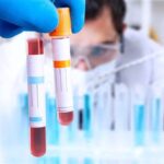 فحص دم يكشف السرطان قبل الأعراض بـ10 سنوات