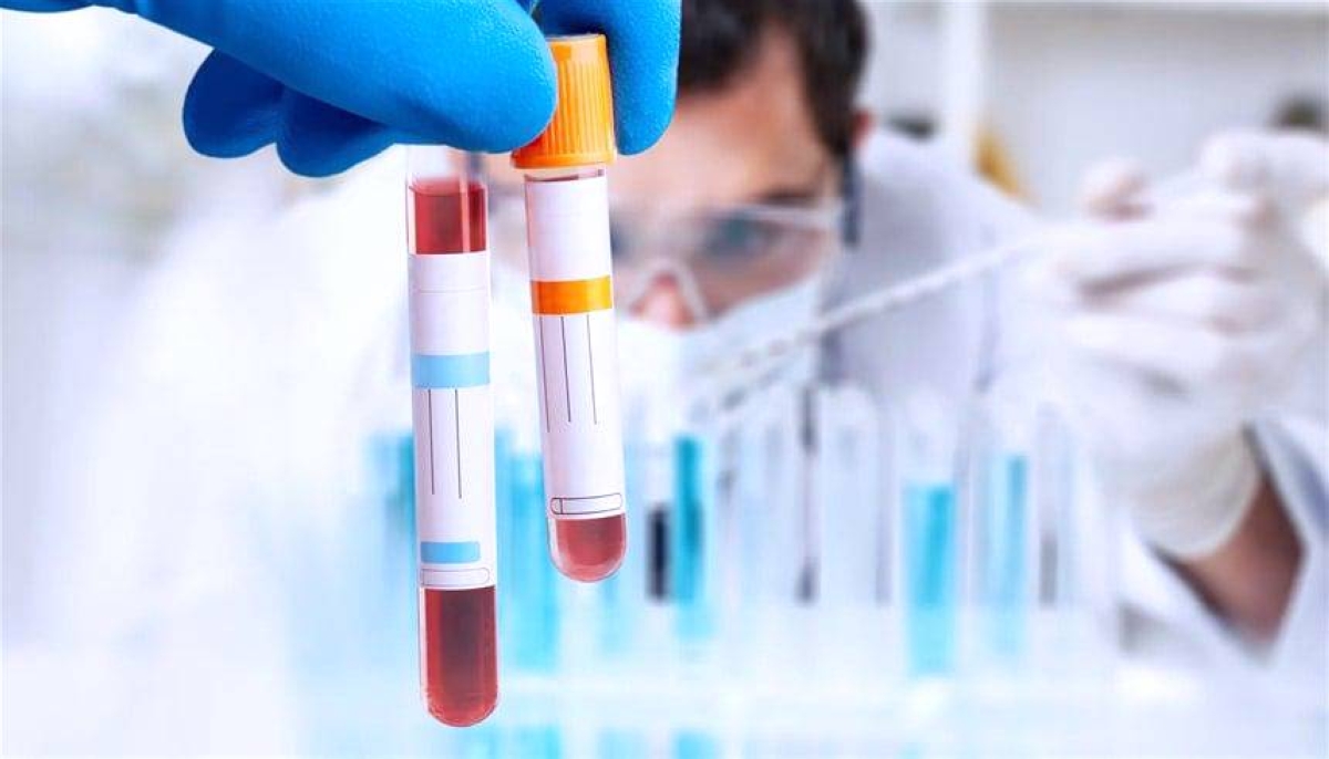 فحص دم يكشف السرطان قبل الأعراض بـ10 سنوات