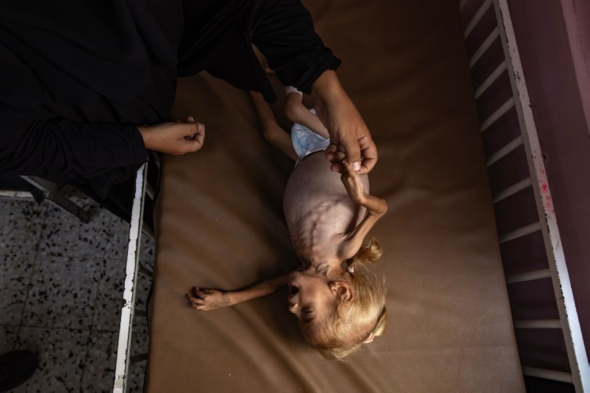 وسط تفاقم «مجاعة غزة».. «قوقل» وإسرائيل تزعمان توفر الطعام وسط تفاقم «مجاعة غزة».. «قوقل» وإسرائيل تزعمان توفر الطعام