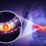 الذرة الحلوة.. حيلة بسيطة تكشف مشكلة مرتبطة بسرطان القولون