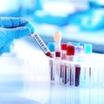 تفاصيل صغيرة تُربك التشخيص الطبي