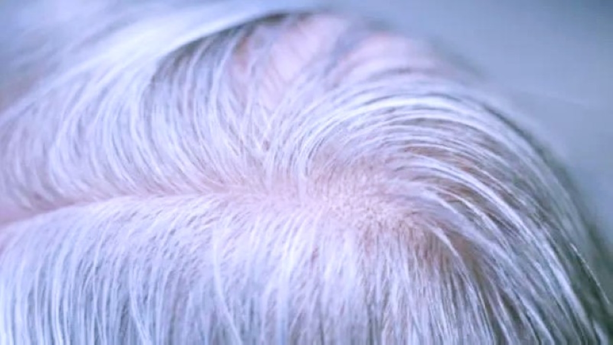 الشيب.. درعٌ خفية تحمي الجسم من سرطان الجلد الشيب.. درعٌ خفية تحمي الجسم من سرطان الجلد