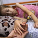 455 شهيدا في قطاع غزة نتيجة سوء التغذية​ 