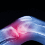 العلاج الأقوى لآلام المفاصل قبل اللجوء للأدوية والجراحة