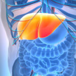 مشروب شائع يشكل درع وقاية من مرض الكبد الدهني