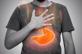 علاقة مقلقة بين الارتجاع الحمضي وصحة القلب علاقة مقلقة بين الارتجاع الحمضي وصحة القلب