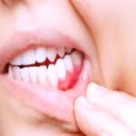 عادات يومية خفية.. طريق السرطان في الفم