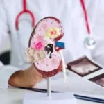 أقسى خيانة زوجية.. محاولة بيع كلية الزوجة!