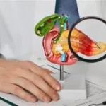 عادات يومية تؤدي إلى التهاب البنكرياس وضعف وظائفه