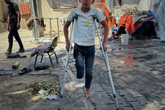 غزة تسجّل أعلى معدل لبتر الأطراف لدى الأطفال​ 