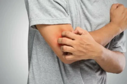 الحكة المزمنة عند كبار السن… حالة معقدة تتطلب اهتماماً شاملاً