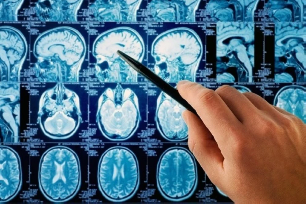 قطرات أنف مبتكرة تعالج سرطان المخ قطرات أنف مبتكرة تعالج سرطان المخ